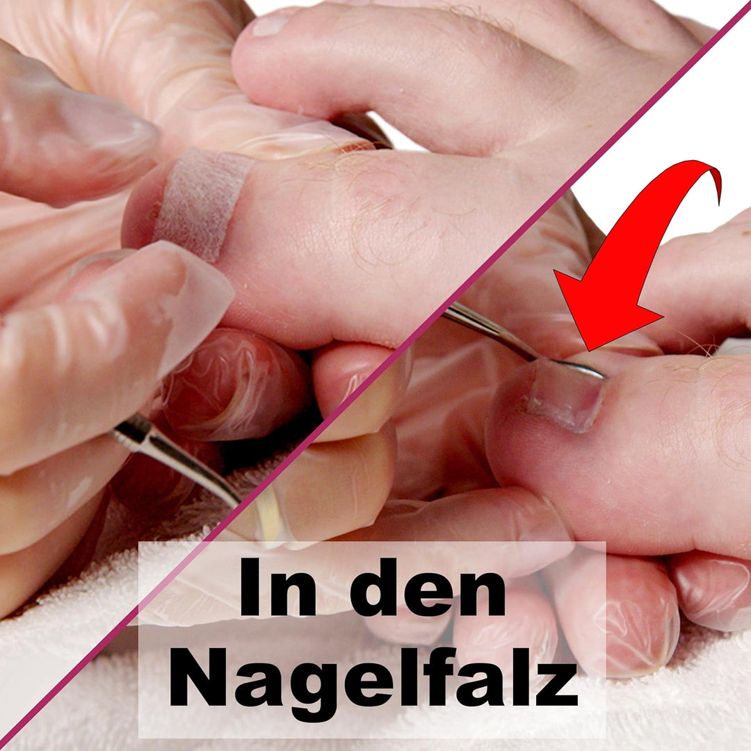 Kosmetex 2x Tamponade für den Nagelfalz 2x Zehenbinde als Schutz, Set 2 6 Stück (1er Pack), 6 St