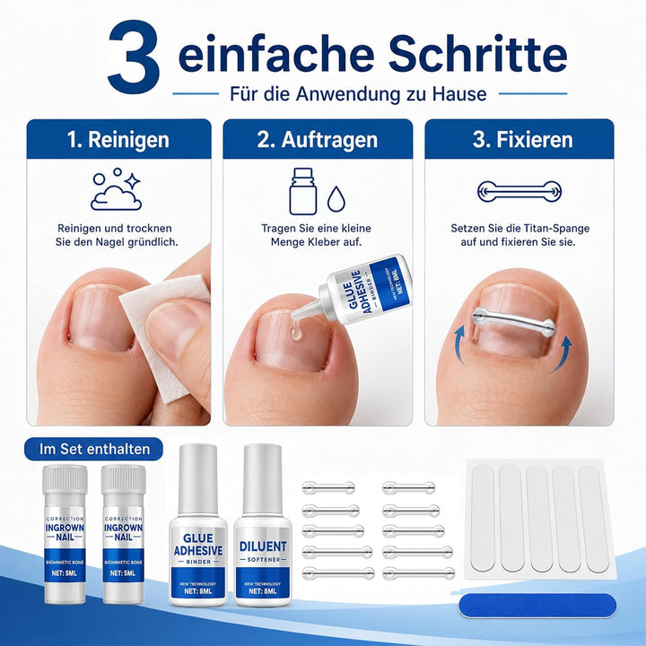 Eingewachsene Zehennägel Set, Korrekturstreifen | für Eingewachsene Zehennägel, Professionelle Anwen