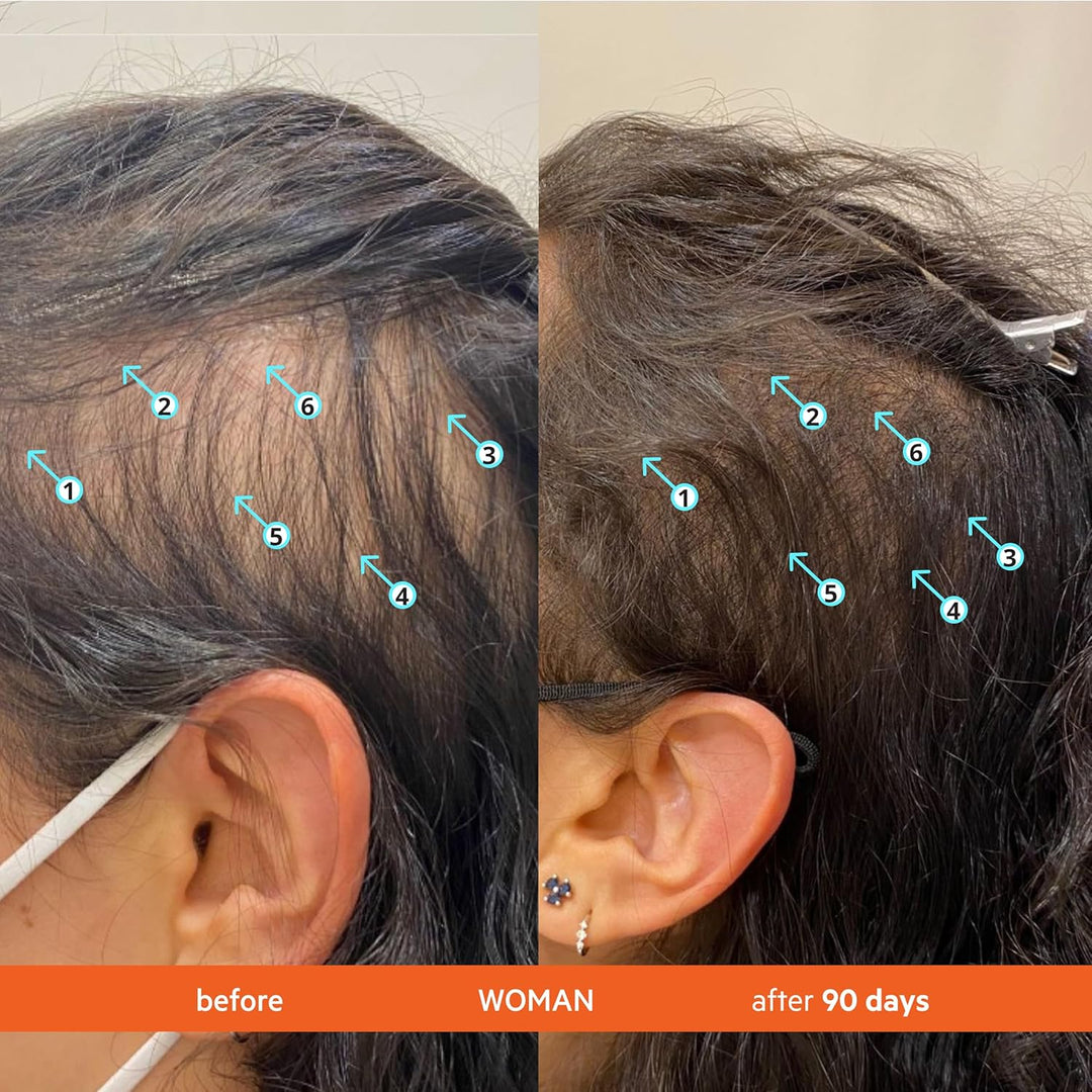 Revita Shampoo und Conditioner für dünner werdendes Haar, unterstützt das Wachstum, stärkt und verdi