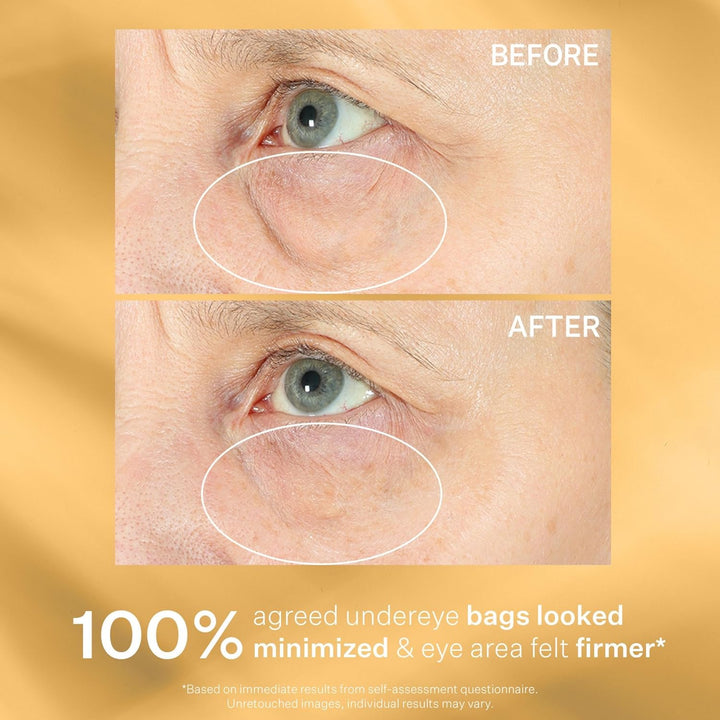 StriVectin Hyperlift Eye Instant Eye Fix0 milliliter Vanilla