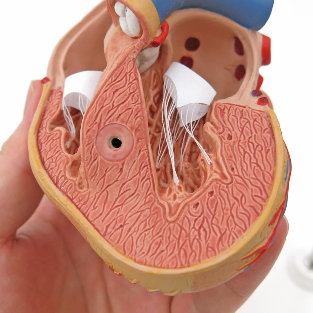 3B Scientific Menschliche Anatomie - Klassik-Herzmodell mit linksventrikulärer Hypertrophie (LVH), 2