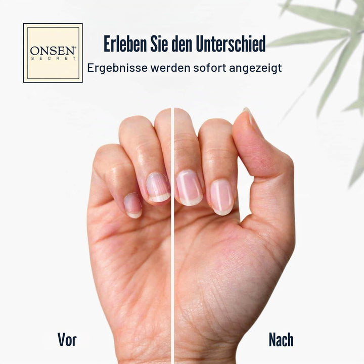 Onsen Secret Japanese Nail Kit - Cuticle Care Oil Serum | Nail Buffer and Shine Kit - Strengthening