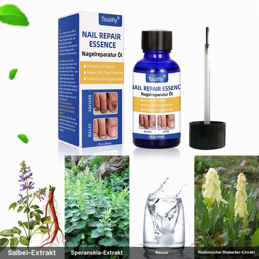Nagelpflege und Behandlung, Nagelpflege für gesunde Fuss und Hand, Nagelpflegeöl,Nagelpflege pflegen