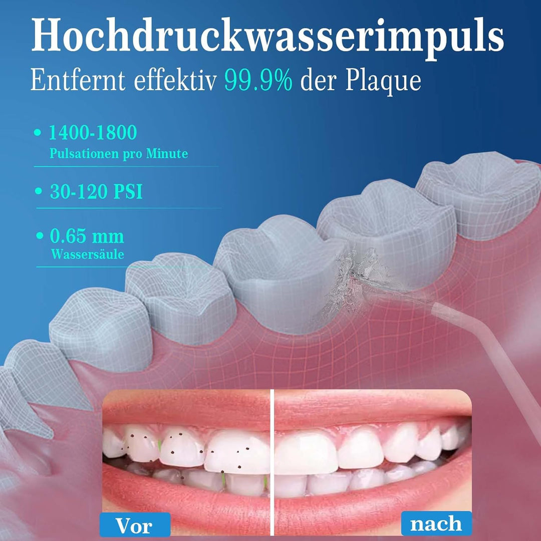SURFOU Munddusche Kabellos Water Flosser for Teeth, Elektrische Zahndusche Wasser Zahnreiniger, Oral