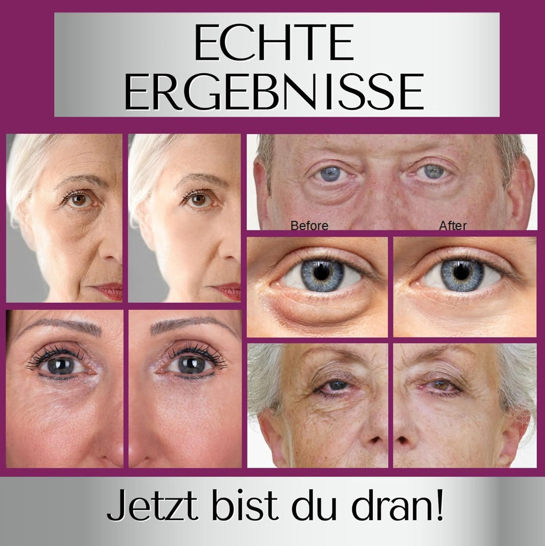 Immaculift Instant Eye Tightener – Augencreme gegen dunkle Ringe und geschwollene Augen – Behandlung
