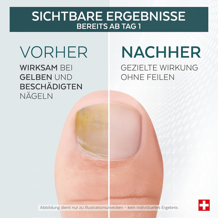 PODERM Tea Tree Nagel-Repair-Serum 6 ml – 4-in-1 Pflege | Verbessert das Erscheinungsbild beschädigt