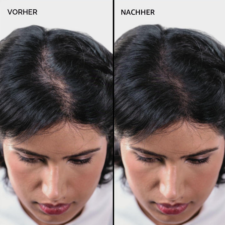 Nanogen Hair Thickening Fibres Black 30g schwarz 30g, schwarz 30g