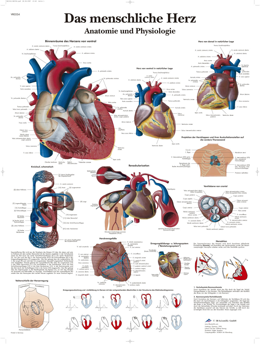 3B Scientific Lehrtafel laminiert - Das menschliche Herz - Anatomie und Pathologie, VR0334L