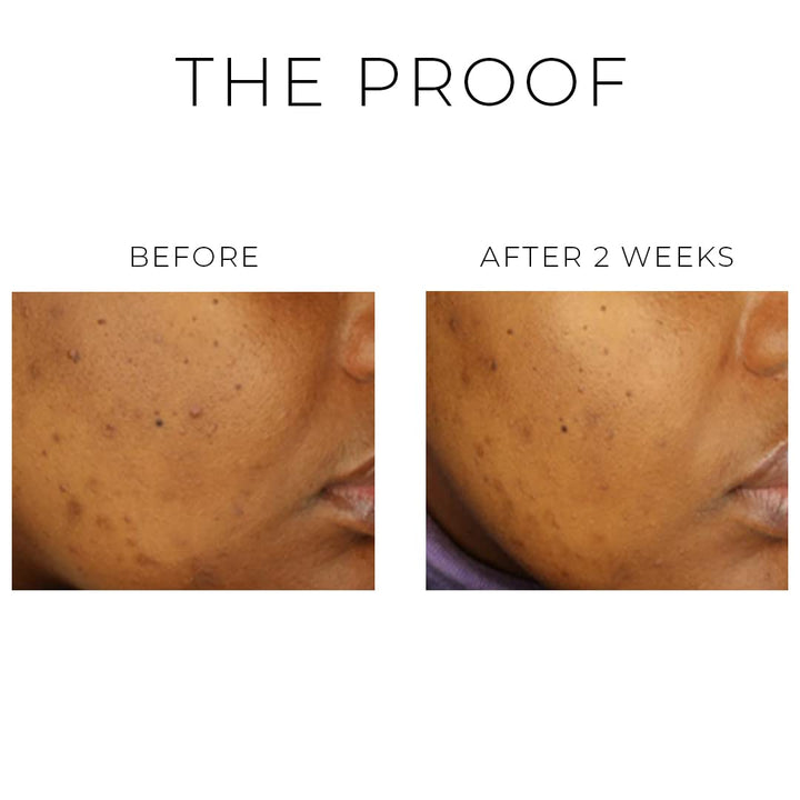 OSKIA Violet Water Clearing Cleanser