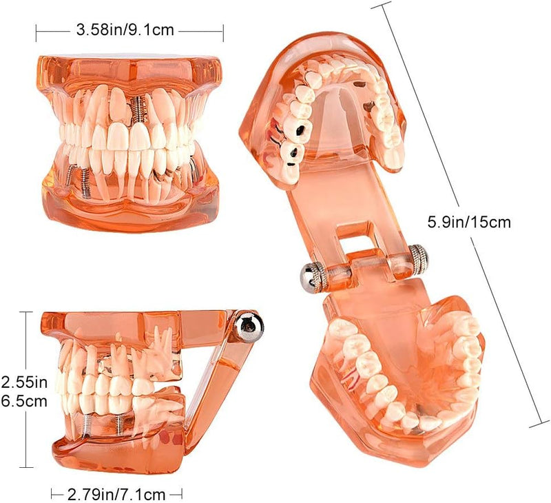 Zahnmodell, abnehmbarer Lernzahn, Modell Orange