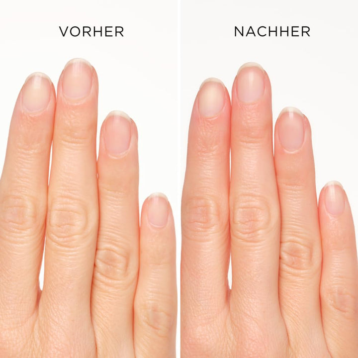 ARTDECO Cuticle Remover Stick - Nagelhautentferner Stift - 1 x 4,5 ml (Packung mit 2) 4.5 ml (2er Pa