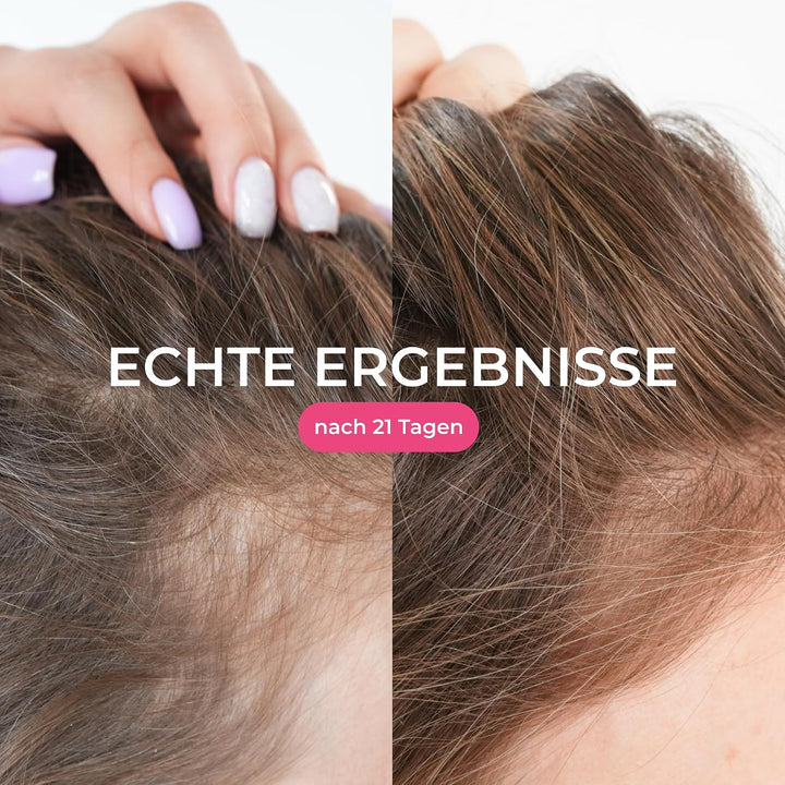 COCOSOLIS GROW Spray Serum für schnelles Haarwachstum - Haarwuchsmittel für Frauen Reduziert Haaraus