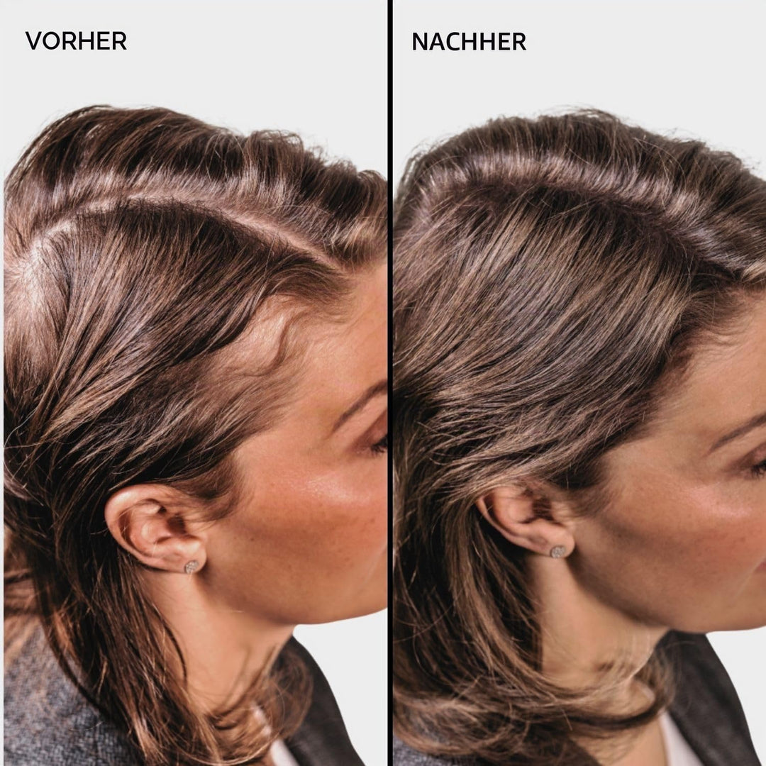 Nanogen Hair Thickening Fibres Light Brown 30g hellbraun 30g, hellbraun 30g