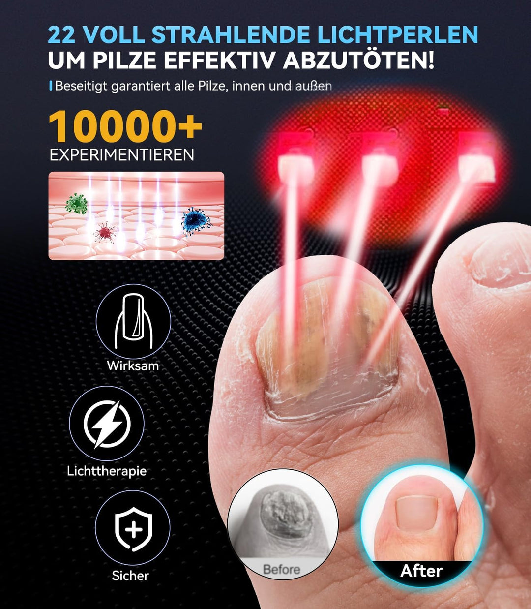 Neues 3.0 Upgrade Nagelpil Laser Gerät【7 Tage Schnell Wirkende】【mit Zeitanzeige - Nagelpil Lasergerä
