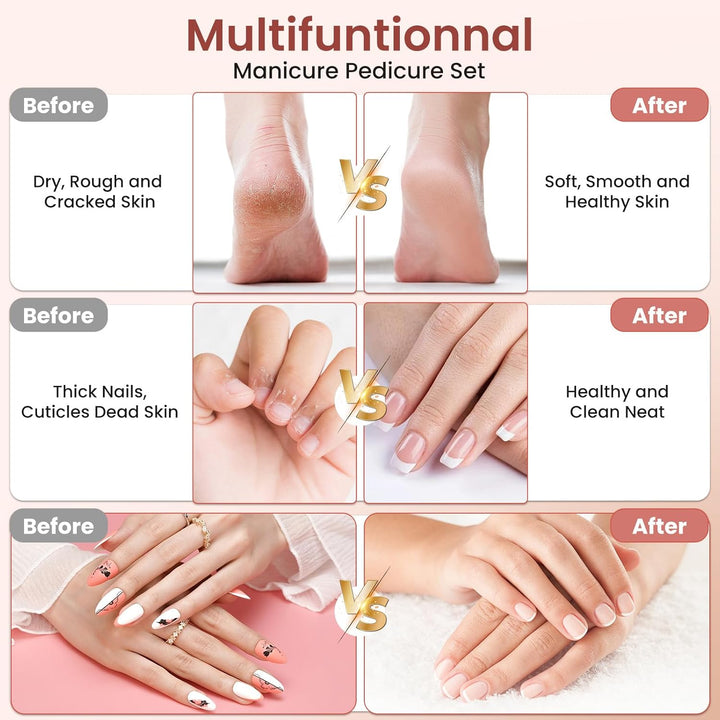 Maniküre/Pediküre Set, Nagelfräser, Kabellos Akku Elektrische Nagelfeile mit 6 Aufsätze zur Nagelpfl