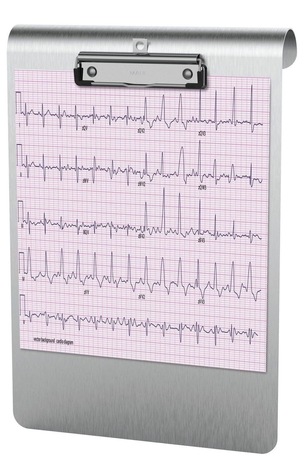 MAUL Klemmbrett MAULmedic zum Einhängen, Schreibplatte, DIN A4 hoch, eloxiertes Aluminium/Edelstahl,