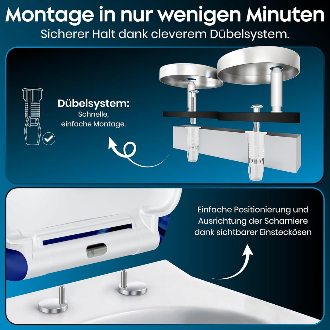 Yelcona WC-Sitz Duroplast,max. Belastung der Klobrille 150 kg Toilettensitz mit Absenkautomatik und