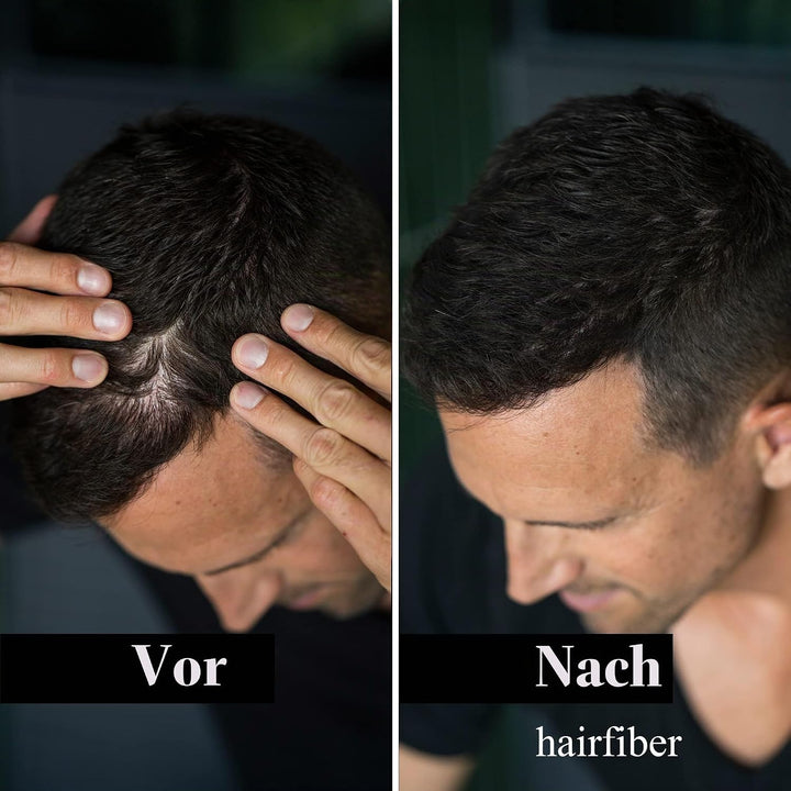 LEON MIGUEL Hair Fiber - Haarverdichtung - Premium Streuhaar/Schütthaar mit Soforteffekt bei Geheimr
