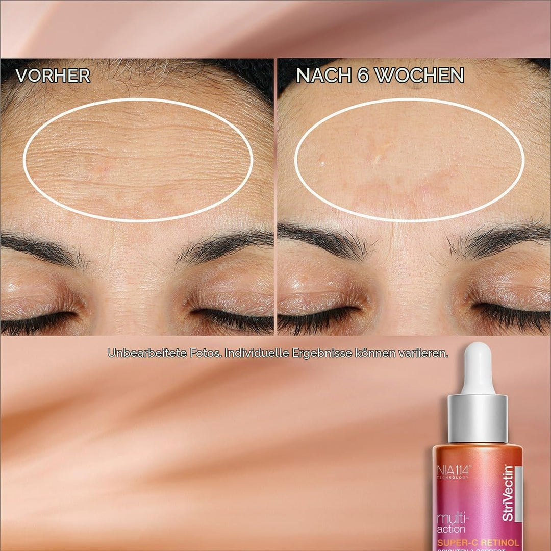 StriVectin SUPER-C RETINOL brighten&amp;correct vitamin C seru 320755 orange 30 ml (1er Pack) Multi-Acti