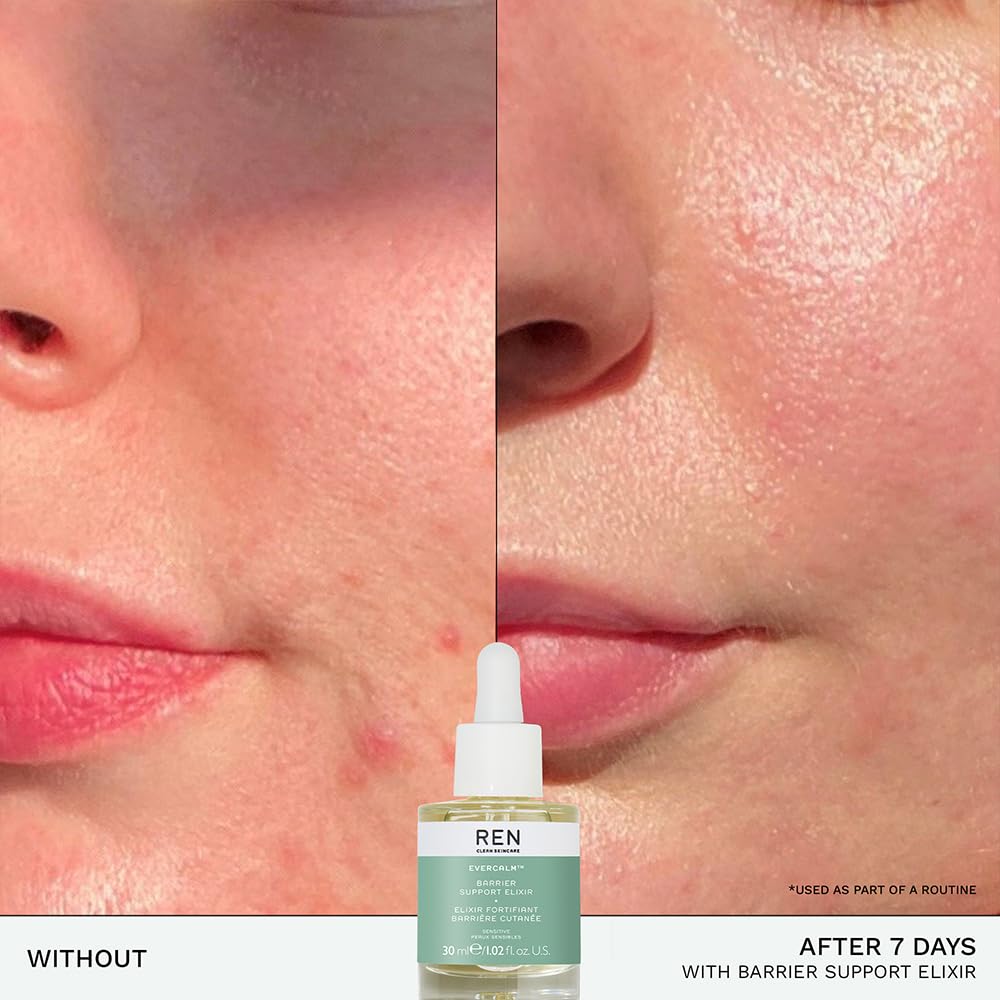 Ren - Evercalm Barrier Support Elixir 30 ml