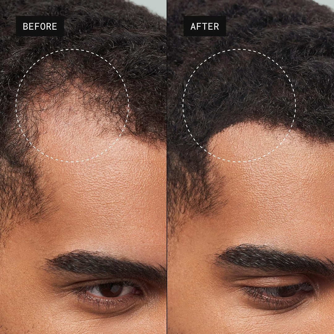 Toppik Haarfasern, Mittelbraun, natürlich gewonnene Fasern aus Keratin für voller aussehendes Haar 5