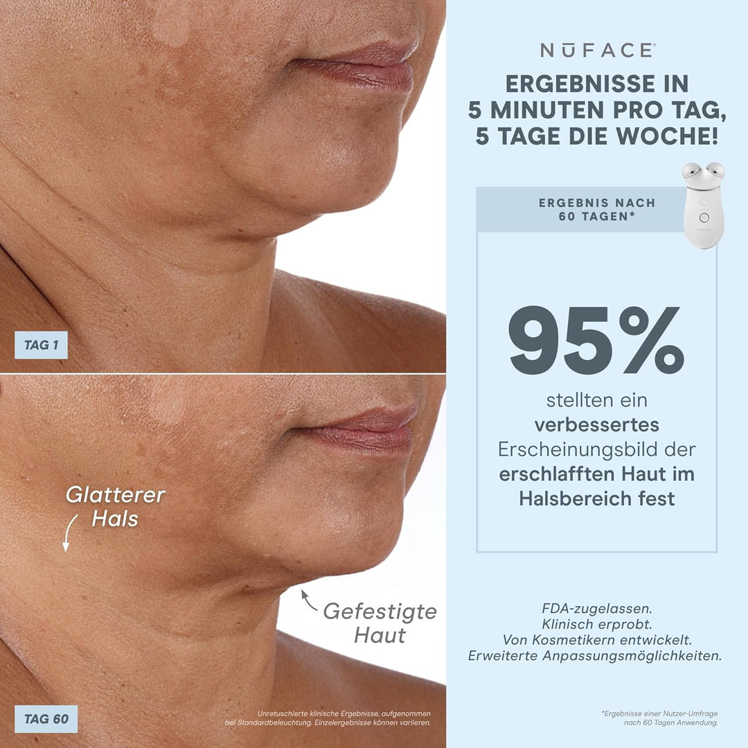 NuFACE TRINITY+ Effective Lip & Eye Attachment Trinity+ Wirksames Lippen- und Augenzubehör, Trinity+