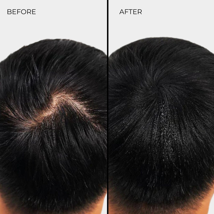 Nanogen Hair Thickening Fibres White 30g weiss 30 g (1er Pack), weiß 30 g (1er Pack)