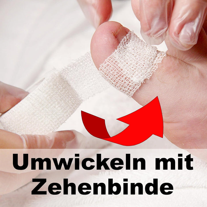 Kosmetex Wattehaken, PediBaehr Nagelweicher, WD Salbe, 2x Tamponade, 1x flexible Zehenbinde, Nagel e