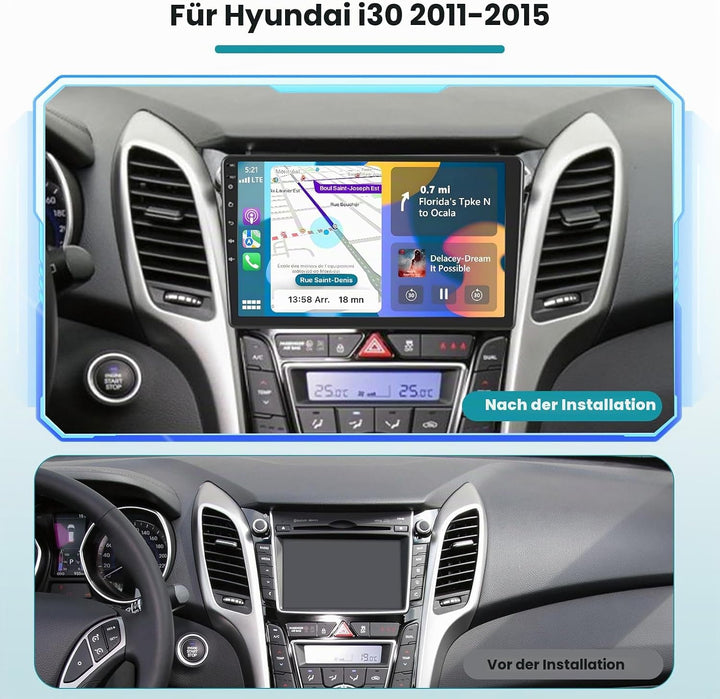 Hikity 2+64G Autoradio Navi Für Hyundai i30 2011-2015 mit Wireless Carplay Android Auto Mirror Link,