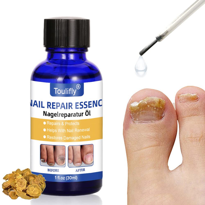 Nagelpflege und Behandlung, Nagelpflege für gesunde Fuss und Hand, Nagelpflegeöl,Nagelpflege pflegen