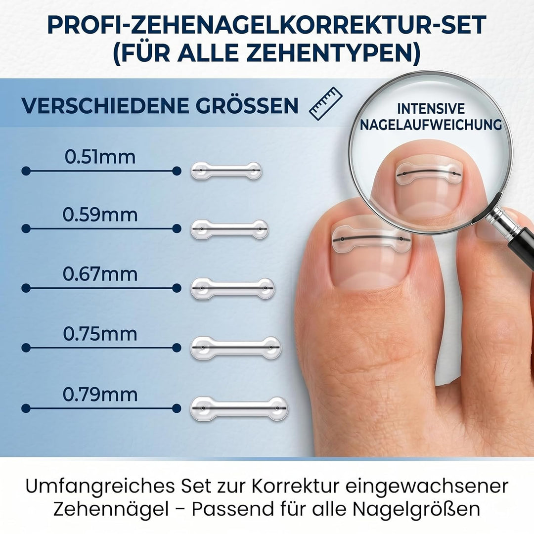 Eingewachsene Zehennägel Set, Zehennägel Korrektur Patch, Nagelspange Fussnägel, Entwickelt für Eing