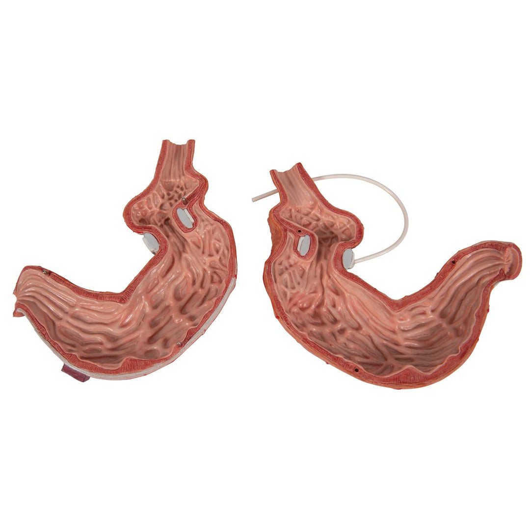3B Scientific Menschliche Anatomie - Magenbandmodell + kostenlose Anatomie App - 3B Smart Anatomy
