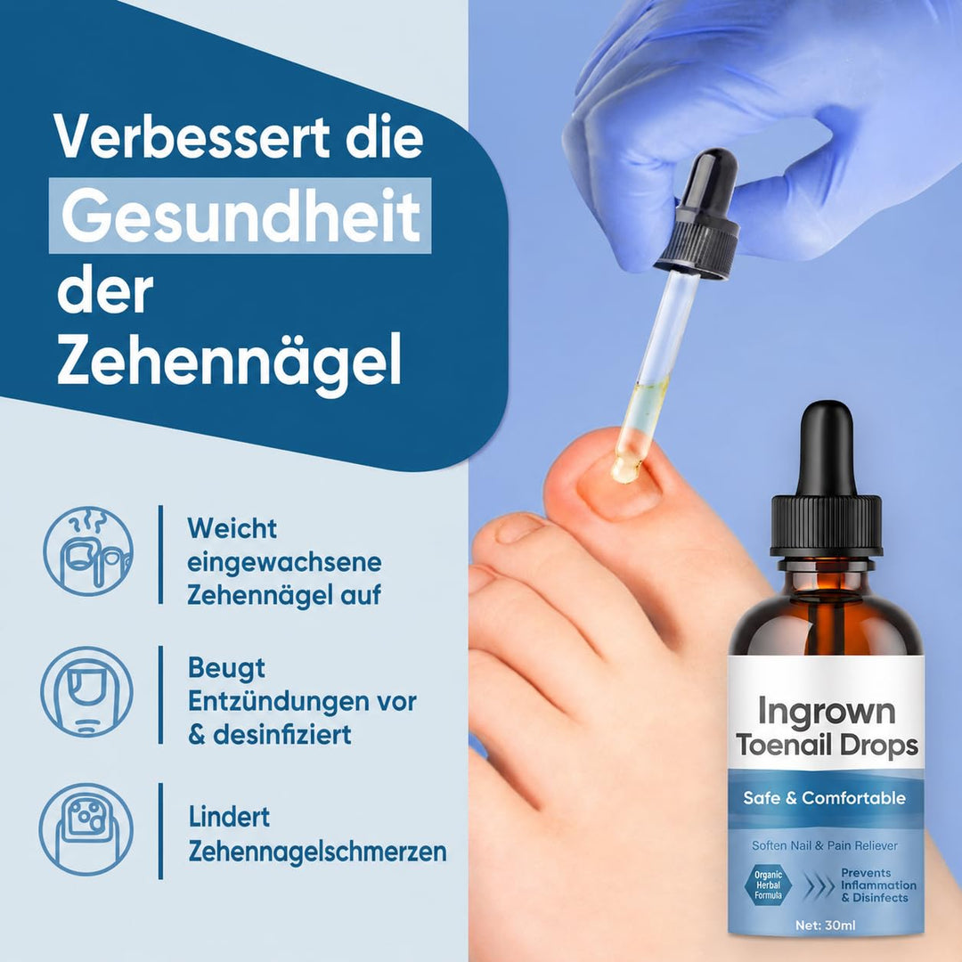Eingewachsene ZehennäGel Tropfen, Korrekturtropfen | FüR Eingewachsene ZehennäGel, Schnell Wirkende