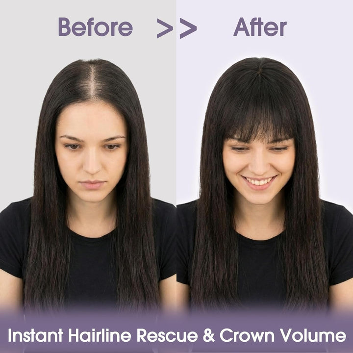 S-noilite Toupets für Frauen mit Pony 8x11cm - 100% Echthaar Topper Hair Extensions Echthaar Damen H