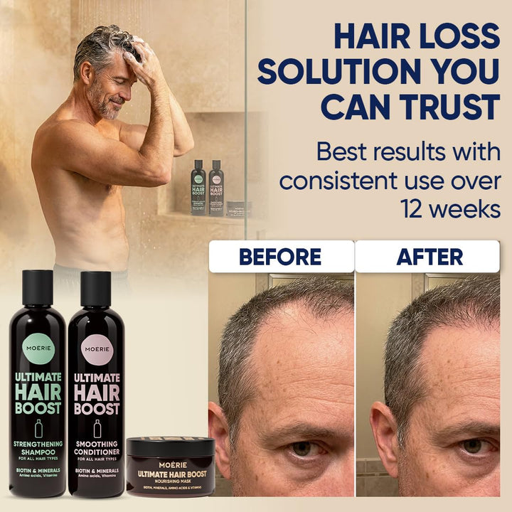 Moerie Mineralstoff-Shampoo Und Conditioner Plus Haarmasken-Paket – Das Ultimative Haarpflegeset – F