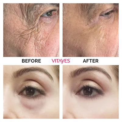 VITAYES Instant Ageback - Anti Aging Creme, Soforteffekt gegen Falten, Tränensäcke und schlaffe Haut