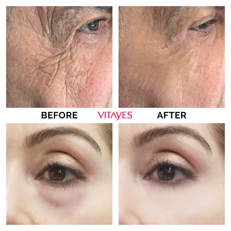 VITAYES Instant Ageback - Anti Aging Creme, Soforteffekt gegen Falten, Tränensäcke und schlaffe Haut