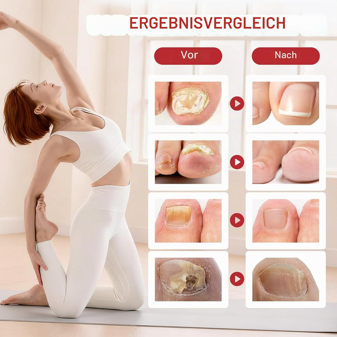 Nagelaufbauserum &amp; Nagelpflege, Nagel Aufbau Serum, Nagelpflege Pflegend, Schutz &amp; Stärkung Nägel, M