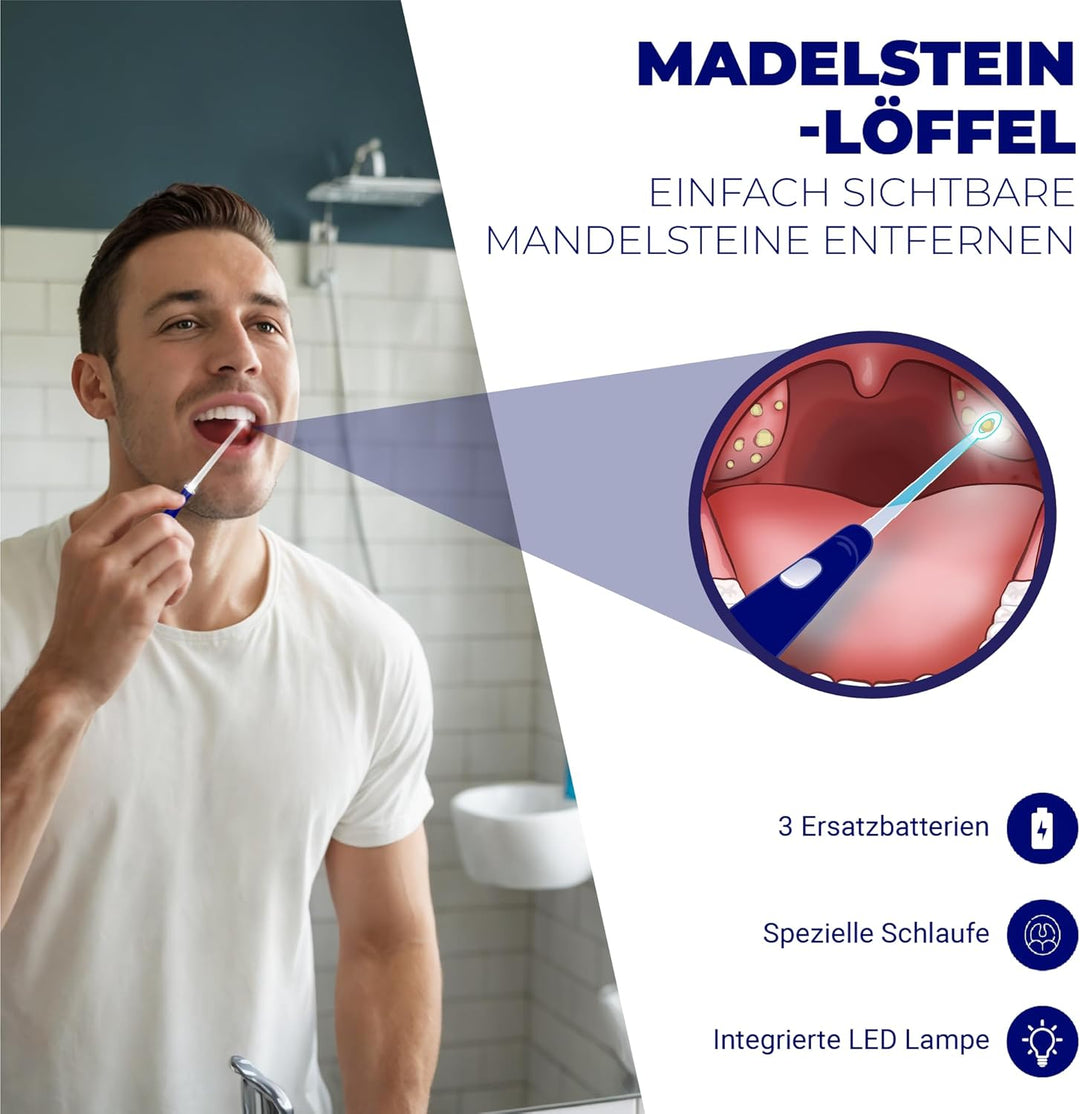 Oravix Mandelsteine Schröpfglas, Mandelsteine Entfernen Sauger, Mundgeruch Bekämpfen, Mandelstein En