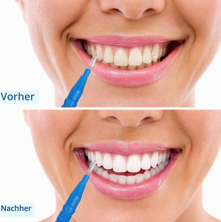 100 Stück Interdentalbürste Zahnstocher Dental Zahnseide Kopf Mundhygiene Interdentalbürste Zahnseid