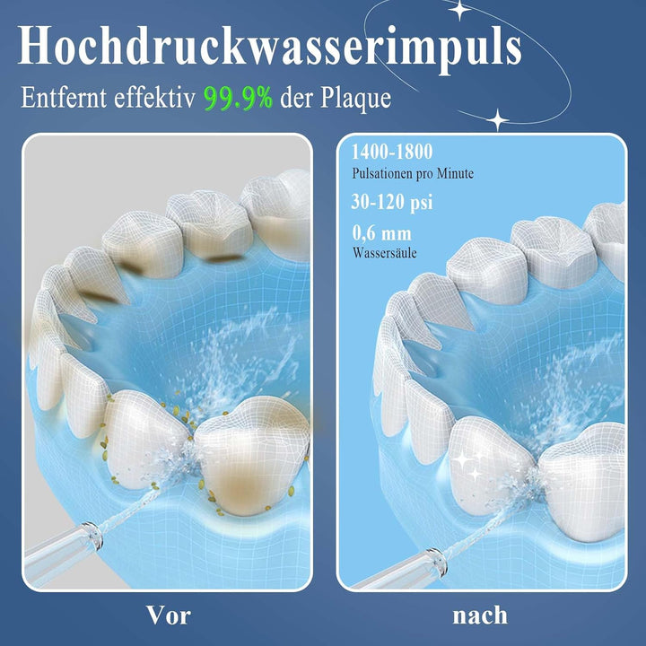 SURFOU Munddusche Kabellos Water Flosser for Teeth, Elektrische Wasserflosser für Zähne Oral Irrigat