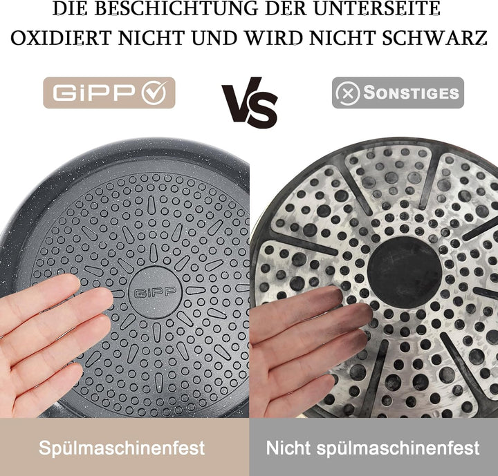 GiPP Keramik Topfset mit Abnehmbarer Griff, 5-Teilig Topf und Pfannenset mit Antihaft Beschichtet, T