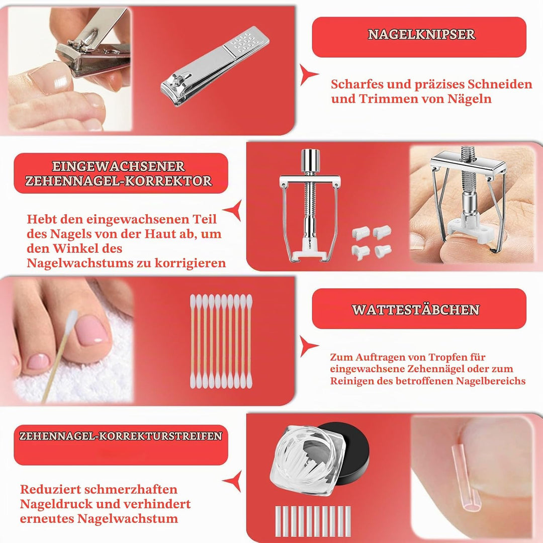 Ingrown Toenail Treatment, ELALRAU Ingrown Toenail Removal Kit with Ingrown Toenail Corrector Drops,