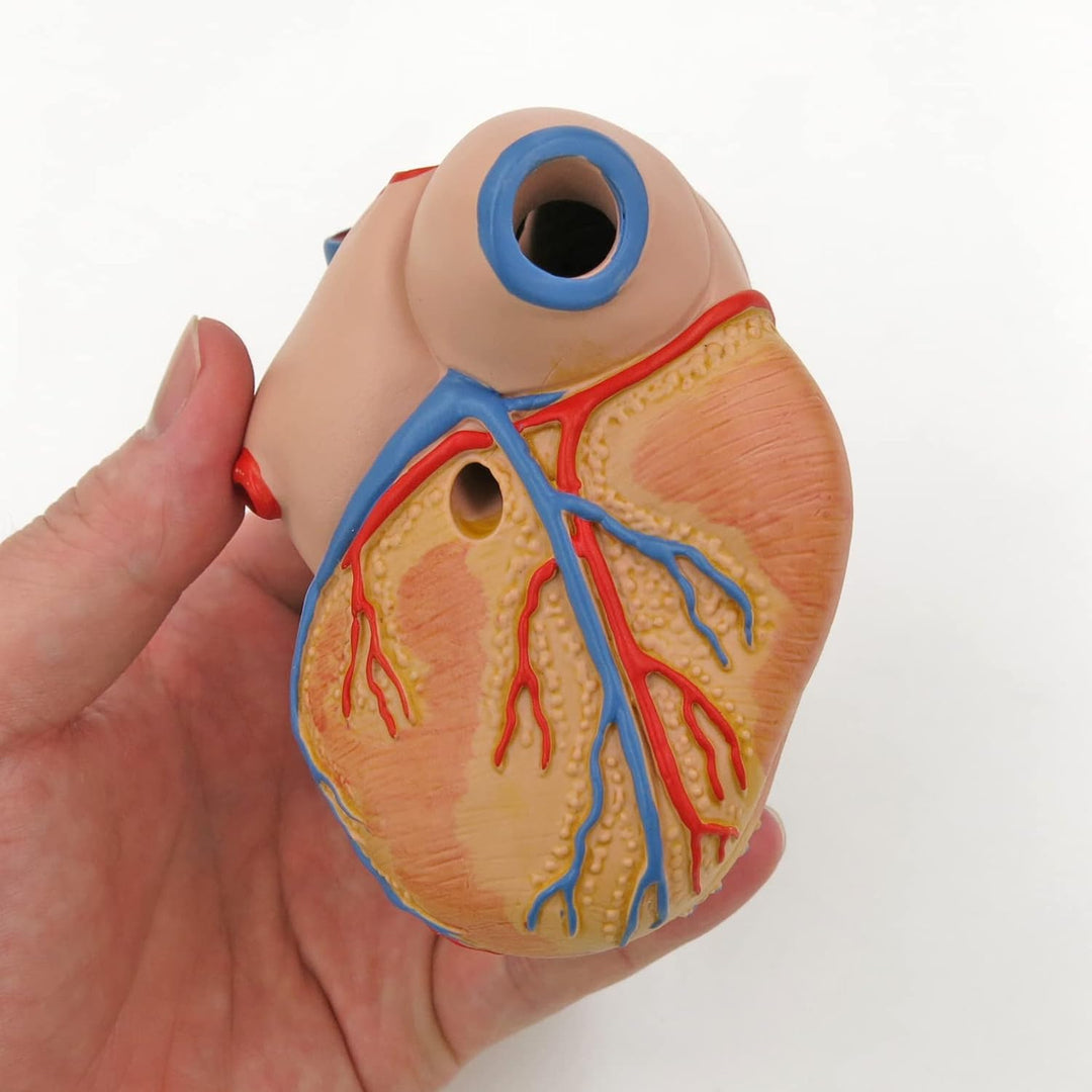 3B Scientific Menschliche Anatomie - Klassik-Herzmodell mit linksventrikulärer Hypertrophie (LVH), 2