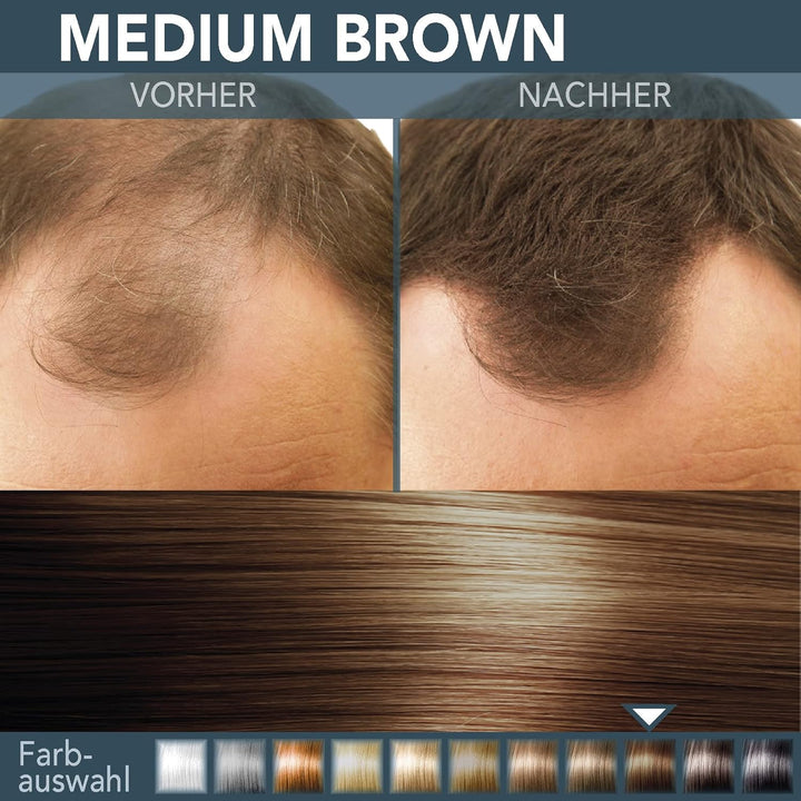 COVER HAIR - Premium Streuhaar 30g | Schütthaar zur Haarverdichtung und Ansatzkaschierung | Authenti