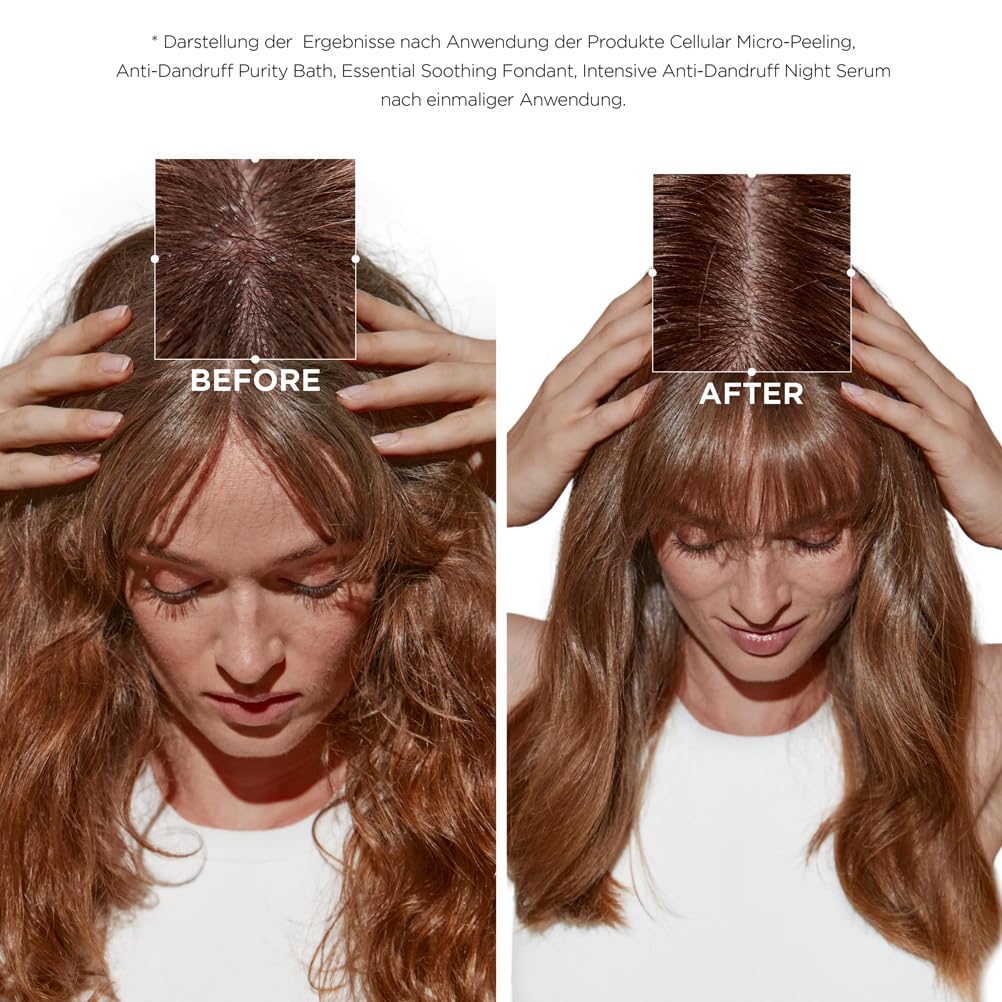 Kérastase, Symbiose, Anti-Schuppen Pflegeroutine mit Shampoo und Pflegespülung, Für empfindliche, tr