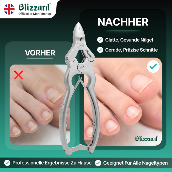 Blizzard Nagelzange für Fussnägel (15cm) - Professionelle Dicke &amp; Eingewachsene Zehennagelknipser -