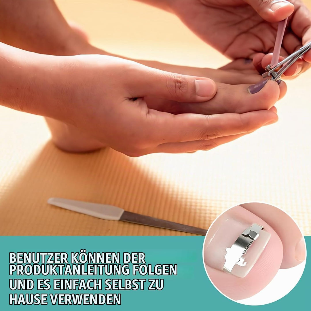 152 Pcs Nagelspange FussNäGel,Eingewachsene ZehennäGel Set,Zehennagel Eingewachsen,Nagelspange FussN