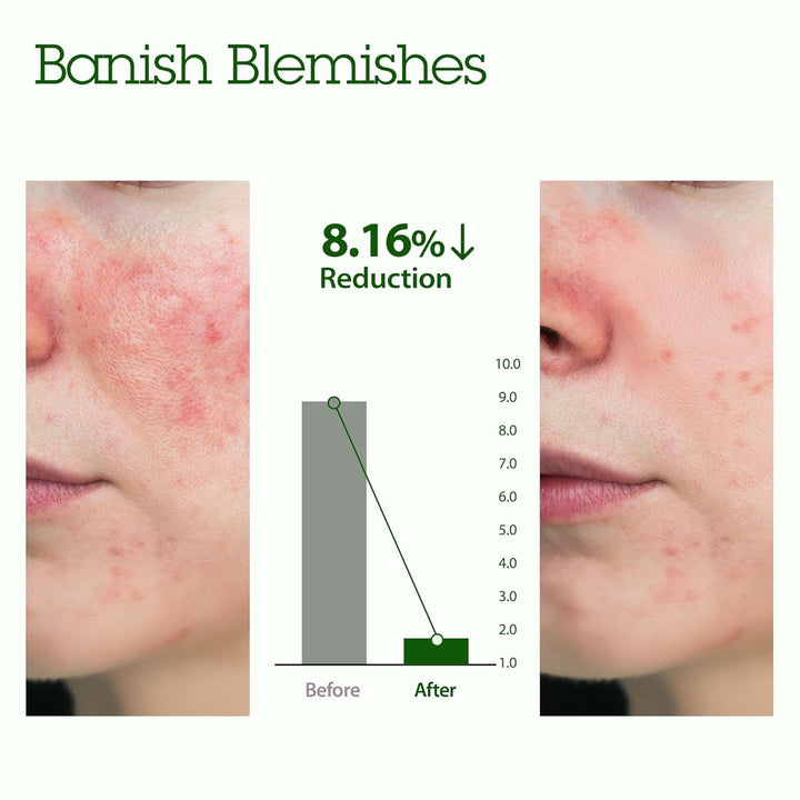 BLITHE Abgetupfte Spritzmaske Gesichtspeeling mit beruhigendem & heilendem Grünem Tee - Milchsäure-P