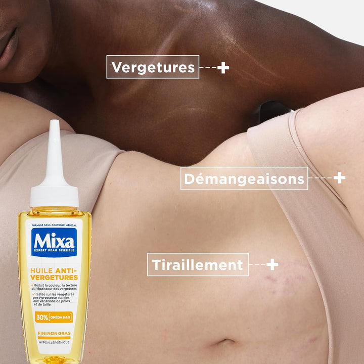 Mixa - Körperöl gegen Dehnungsstreifen - 30% Omega-6 & 9 - Reduziert Farbe, Textur und Dicke von Deh